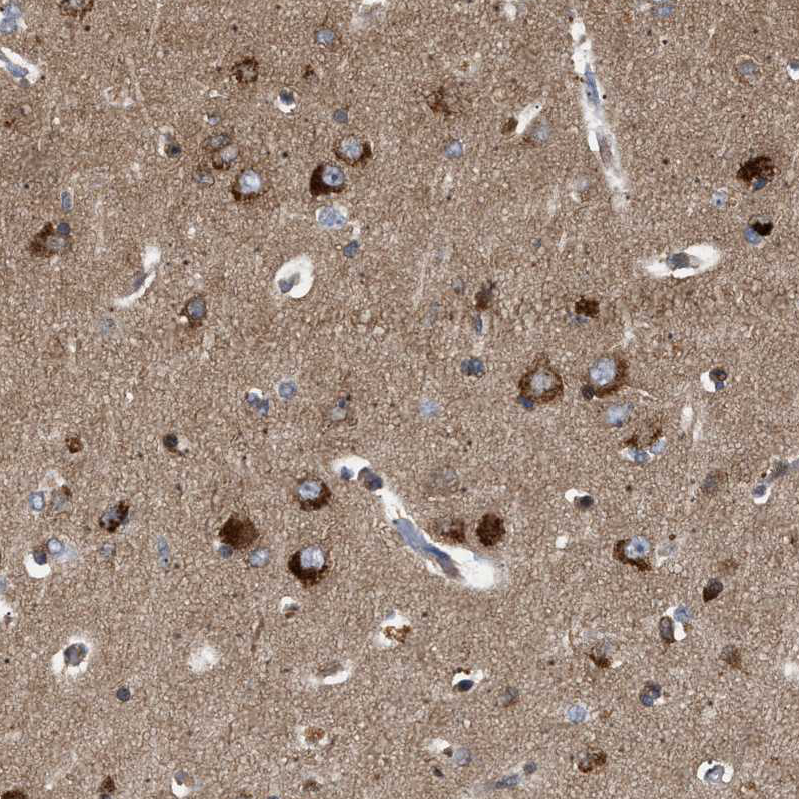 Anti-GUCY1B3 Antibody