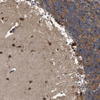 Immunohistochemical staining of human cerebellum shows strong cytoplasmic positivity in molecular layer.