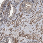 Immunohistochemical staining of human prostate shows strong cytoplasmic positivity in smooth muscle cells.