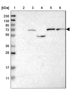 Lane 1: Marker [kDa] 230, 130, 95, 72, 56, 36, 28, 17, 11_br/_Lane 2: Human cell line RT-4_br/_Lane 3: Human cell line U-251MG sp_br/_Lane 4: Human plasma (IgG/HSA depleted)_br/_Lane 5: Human liver tissue_br/_Lane 6: Human tonsil tissue