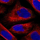 Immunofluorescent staining of human cell line U-2 OS shows localization to vesicles.