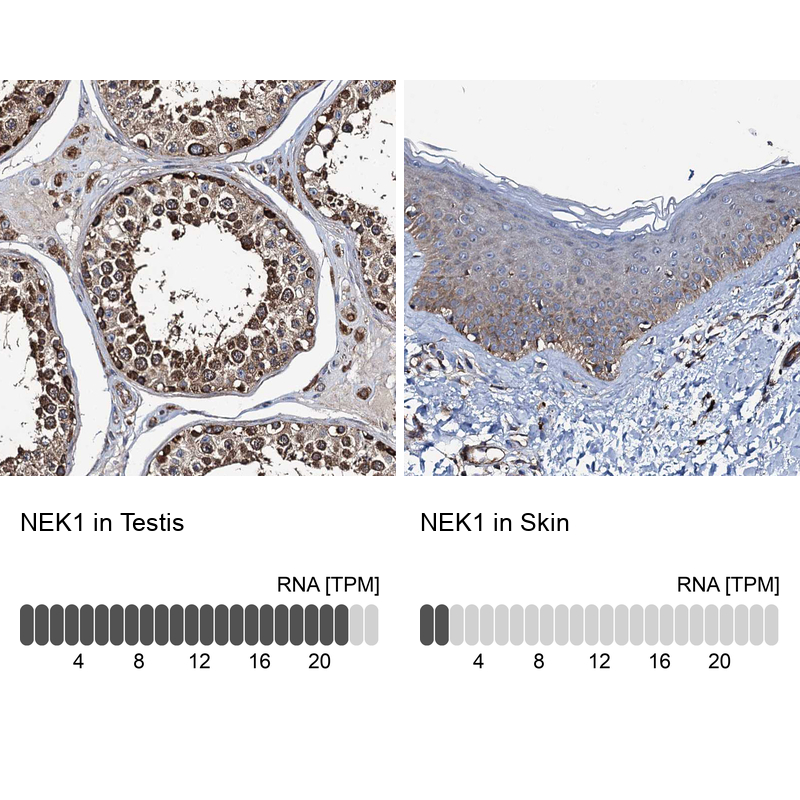 Anti-NEK1 Antibody
