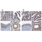 Immunohistochemical staining of human endometrium, fallopian tube, skin and testis using Anti-NEK1 antibody HPA020873 (A) shows similar protein distribution across tissues to independent antibody HPA040413 (B).