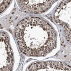Immunohistochemical staining of human testis shows strong cytoplasmic positivity in cells in seminiferous ducts.
