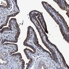 Immunohistochemical staining of human Fallopian tube shows strong cytoplasmic/ membranous positivity in glandular cells.
