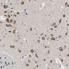 Anti-SRPK2 Antibody