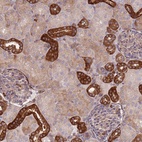 Anti-ZMYM5 Antibody