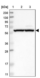 Lane 1: Marker [kDa] 230, 130, 95, 72, 56, 36, 28, 17, 11_br/_Lane 2: Human cell line RT-4_br/_Lane 3: Human cell line U-251MG sp