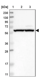 Lane 1: Marker [kDa] 230, 130, 95, 72, 56, 36, 28, 17, 11_br/_Lane 2: Human cell line RT-4_br/_Lane 3: Human cell line U-251MG sp