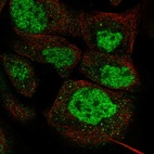 Immunofluorescent staining of human cell line A-431 shows localization to nucleoplasm.