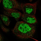 Immunofluorescent staining of human cell line A-431 shows localization to nucleoplasm.