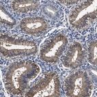 Anti-SOCS5 Antibody