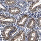 Anti-SOCS5 Antibody