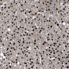 Anti-ZNF20 Antibody