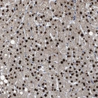 Anti-ZNF20 Antibody