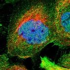 Immunofluorescent staining of human cell line A-431 shows localization to nucleoplasm & plasma membrane.