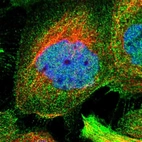 Immunofluorescent staining of human cell line A-431 shows localization to nucleoplasm & plasma membrane.