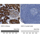Anti-ASS1 Antibody