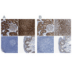 Immunohistochemical staining of human kidney, liver, lymph node and skin using Anti-ASS1 antibody HPA020896 (A) shows similar protein distribution across tissues to independent antibody HPA020934 (B).