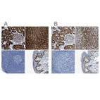 Immunohistochemical staining of human kidney, liver, lymph node and skin using Anti-ASS1 antibody HPA020896 (A) shows similar protein distribution across tissues to independent antibody HPA020934 (B).