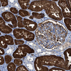 Immunohistochemical staining of human kidney shows strong cytoplasmic positivity in cells in proximal tubules.
