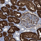 Immunohistochemical staining of human kidney shows strong cytoplasmic positivity in cells in proximal tubules.