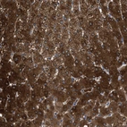 Immunohistochemical staining of human liver shows strong cytoplasmic positivity in hepatocytes.