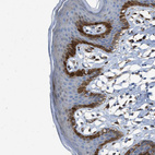 Immunohistochemical staining of human skin shows strong cytoplasmic positivity in a subset of squamous epithelial cells.