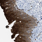 Immunohistochemical staining of human urinary bladder shows strong cytoplasmic positivity in urothelial cells.