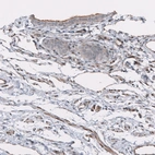 Immunohistochemical staining of human fallopian tube shows moderate positivity in apical membrane in ciliated glandular cells.