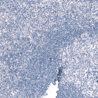 Immunohistochemical staining of human tonsil shows no positivity in non-germinal center cells as expected.
