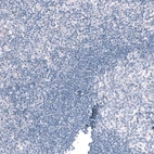 Immunohistochemical staining of human tonsil shows no positivity in non-germinal center cells as expected.