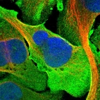 Immunofluorescent staining of human cell line U-2 OS shows localization to plasma membrane.