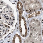 Immunohistochemical staining of human kidney using Anti-SERTAD2 antibody HPA020904.