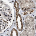 Immunohistochemical staining of human kidney using Anti-SERTAD2 antibody HPA020904.