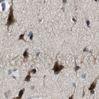 Immunohistochemical staining of human cerebral cortex using Anti-SERTAD2 antibody HPA020904.