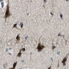 Immunohistochemical staining of human cerebral cortex using Anti-SERTAD2 antibody HPA020904.