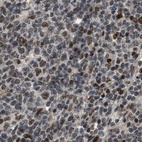 Immunohistochemical staining of human lymph node using Anti-SERTAD2 antibody HPA020904.
