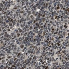 Immunohistochemical staining of human lymph node using Anti-SERTAD2 antibody HPA020904.