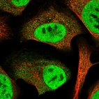 Immunofluorescent staining of human cell line U-2 OS shows localization to nucleoplasm & cytosol.