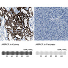 Anti-AMACR Antibody