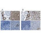 Immunohistochemical staining of human kidney, liver, lymph node and pancreas using Anti-AMACR antibody HPA020912 (A) shows similar protein distribution across tissues to independent antibody HPA019527 (B).