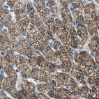Immunohistochemical staining of human liver using Anti-AMACR antibody HPA020912.