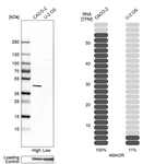Western blot analysis in human cell lines Caco-2 and U2OS using Anti-AMACR antibody. Corresponding AMACR RNA-seq data are presented for the same cell lines. Loading control: Anti-GAPDH.