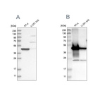 Anti-AMACR Antibody