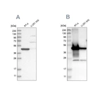 Western blot analysis using Anti-AMACR antibody HPA020912 (A) shows similar pattern to independent antibody HPA019527 (B).