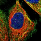 Immunofluorescent staining of human cell line A-431 shows localization to plasma membrane & vesicles.