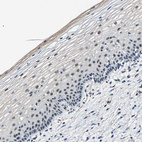 Immunohistochemical staining of human skin shows moderate nuclear positivity in squamous epithelial cells.