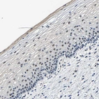 Immunohistochemical staining of human skin shows moderate nuclear positivity in squamous epithelial cells.