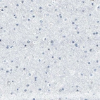 Immunohistochemical staining of human cerebral cortex shows no nuclear positivity in neuronal cells as expected.